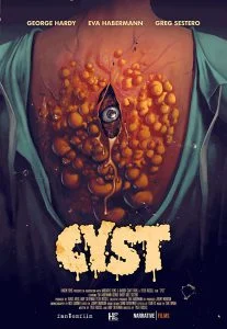 ดูหนัง Cyst (2020) HD